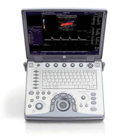GE Logiq E Portable Ultrasound GE Logiq E Portable Ultrasound