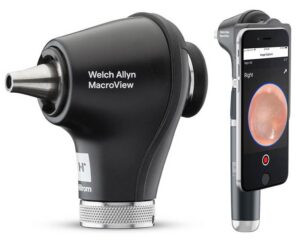 Welch Allyn MacroView Otoscope (Refurbished)