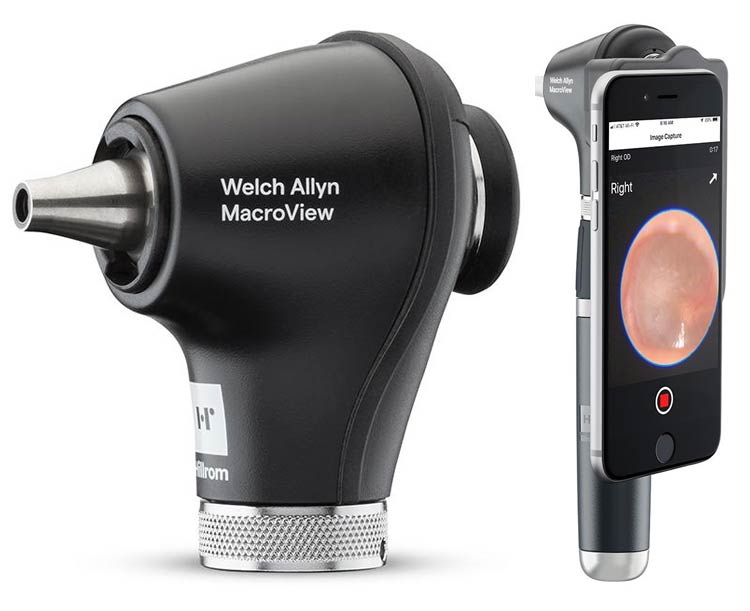 Welch Allyn MacroView Otoscope Welch Allyn MacroView Otoscope