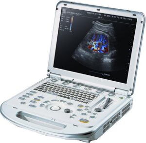 Mindray M7 Portable Ultrasound (Refurbished)